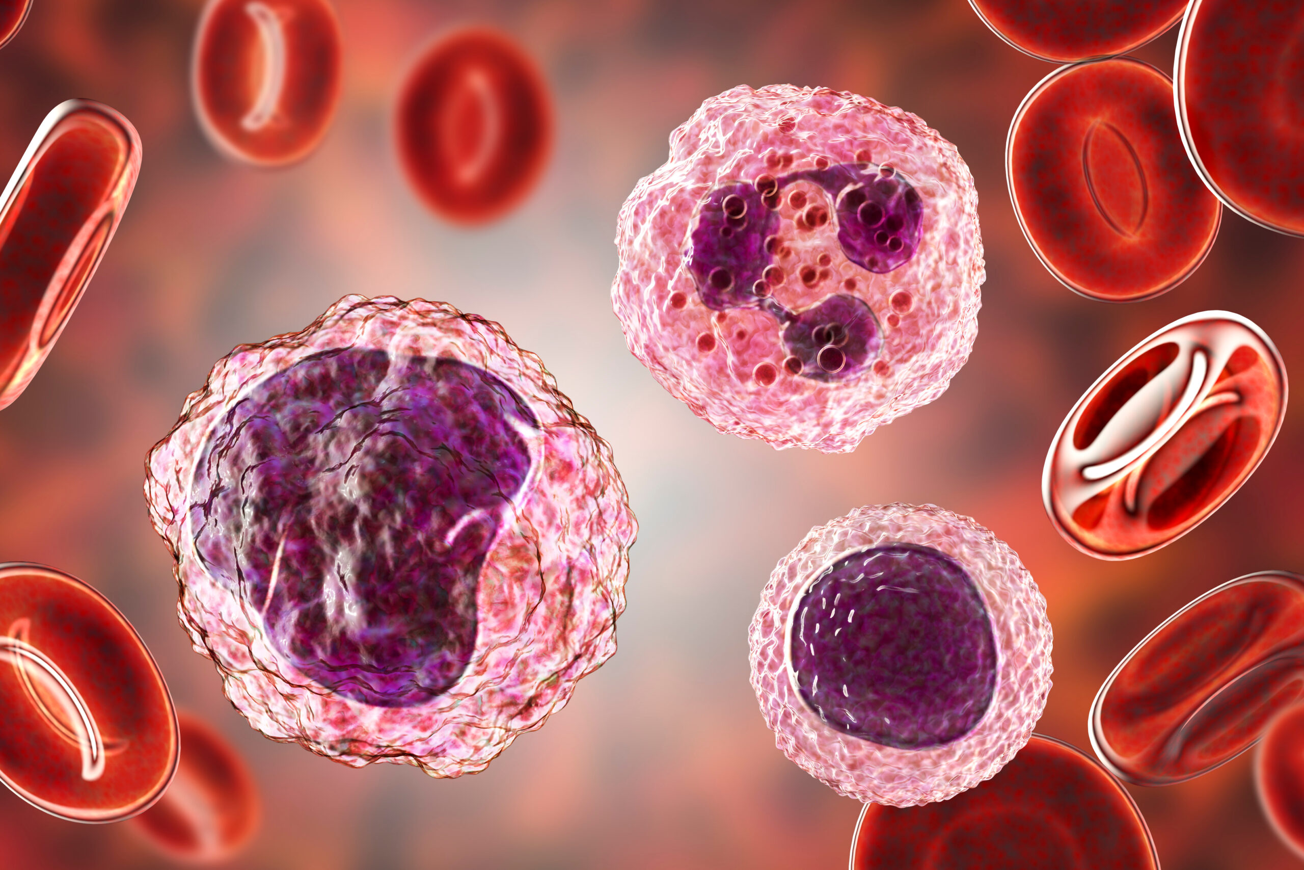UCMNC therapy